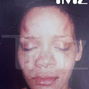 Rihanna cu fata tumefiata